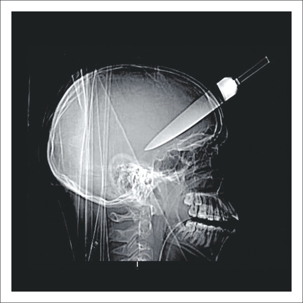 Frankie Teardrop - Single album cover