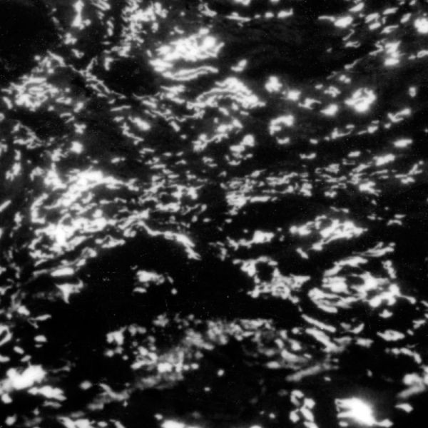 A I A : Dream Loss album cover