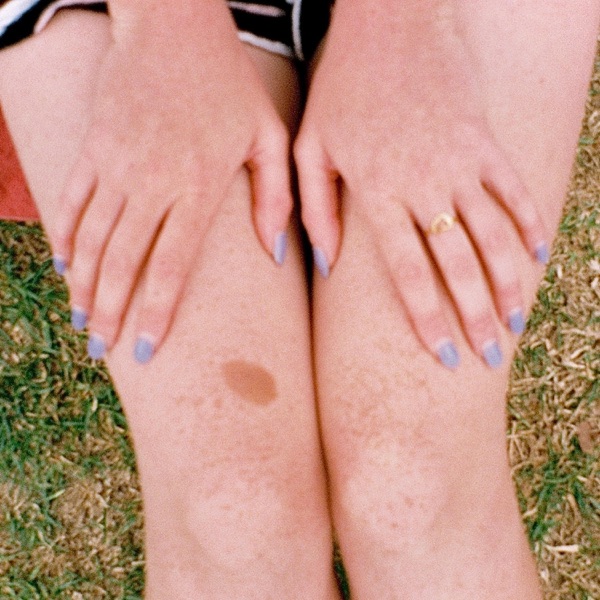 Freckles album cover