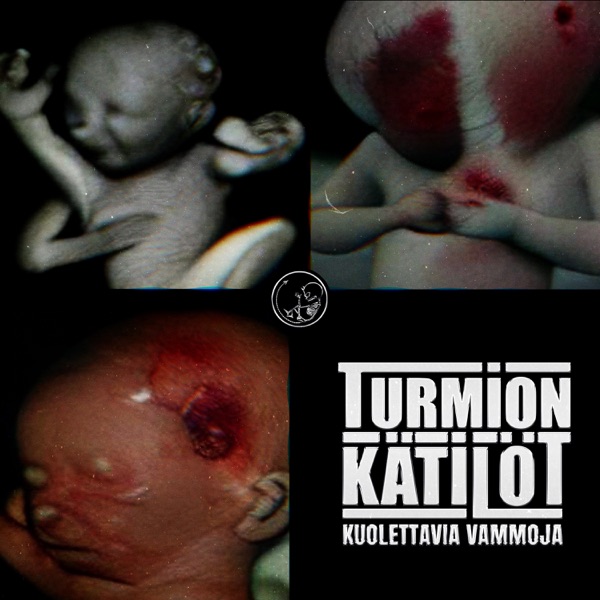 Kuolettavia Vammoja - Single album cover