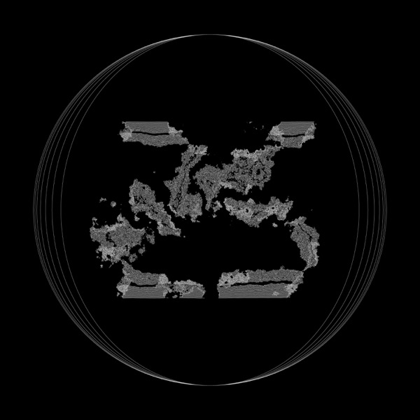 Erase (Nico Casal Remix) - Single album cover