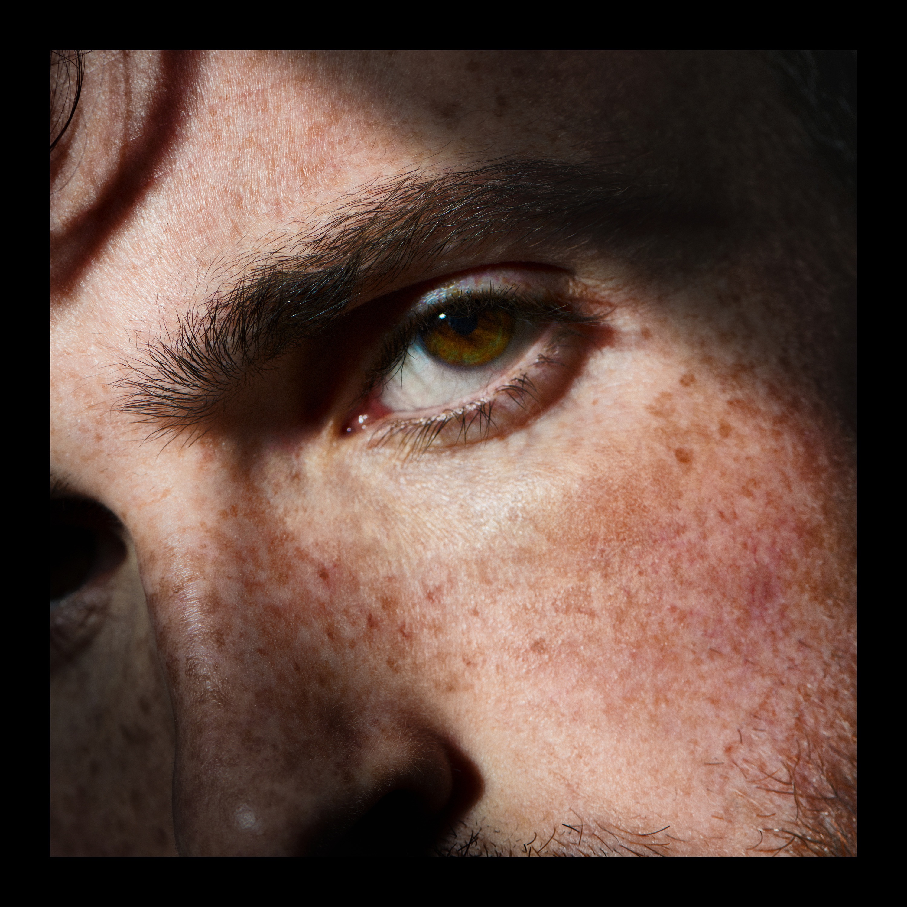 Worlds On Fire - EP album cover