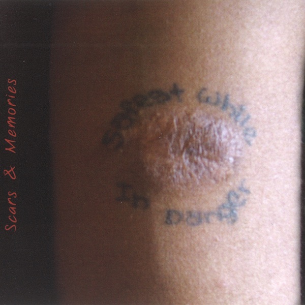 Scars & Memories - Single album cover