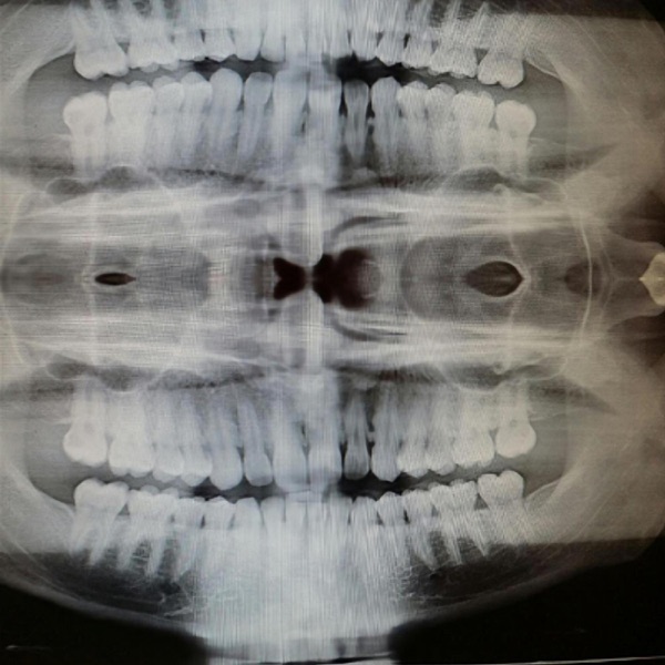 White Rapper (feat. Rittz & Jacc D Frost) [403Mix] - Single album cover