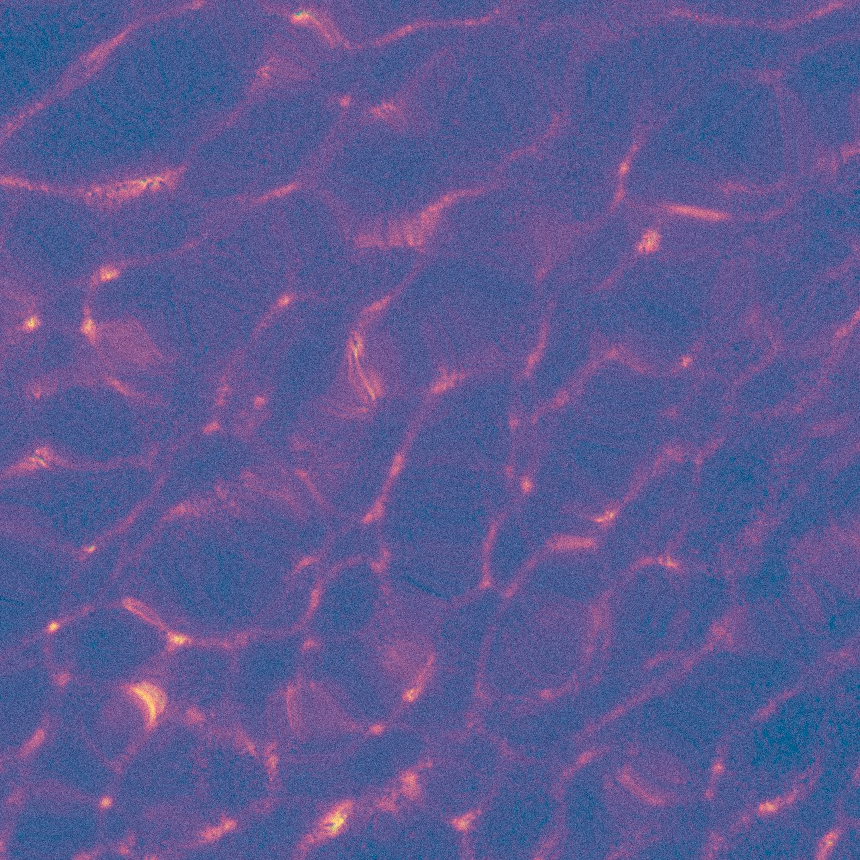 Ripple - Single album cover