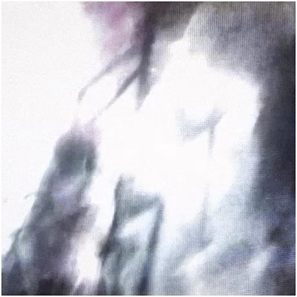 anything else - Single album cover