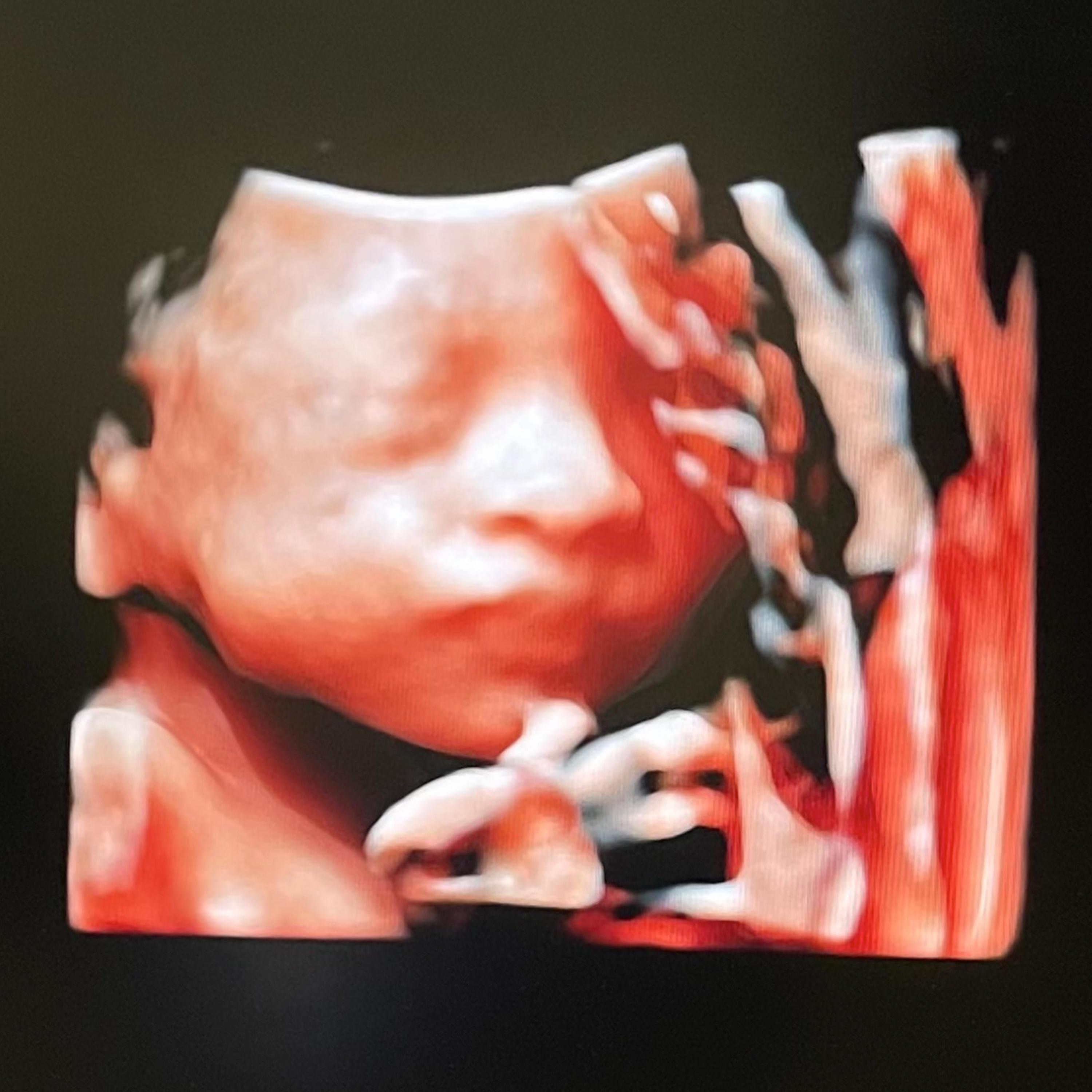 Back For You - Single album cover