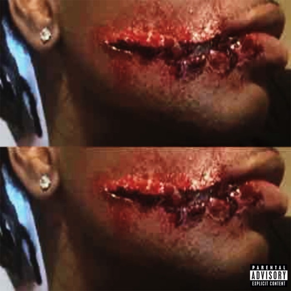overseas - Single album cover