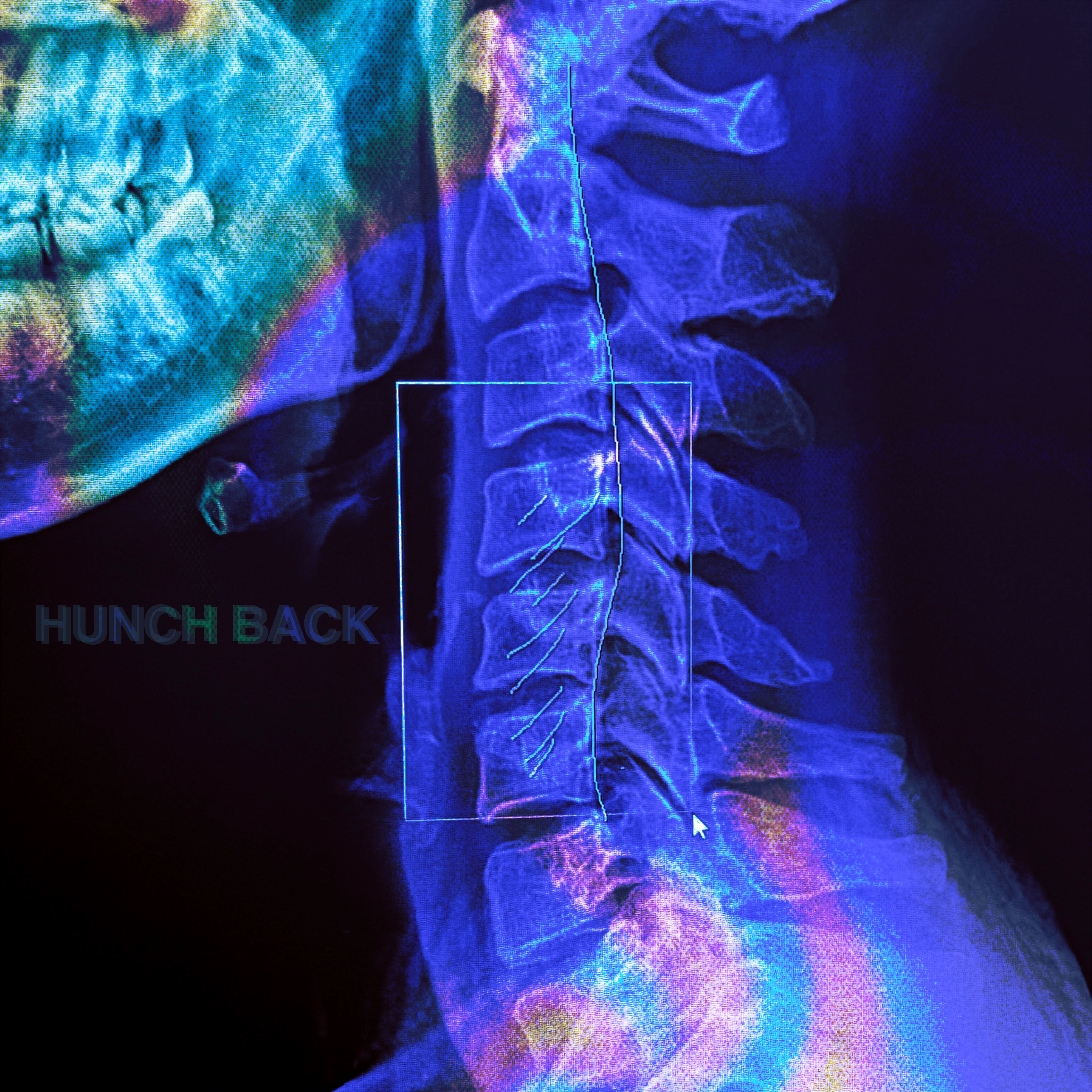HUNCHBACK - Single album cover